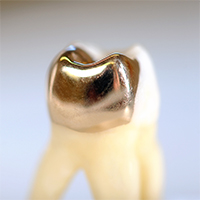 Zahn mit Goldfüllung